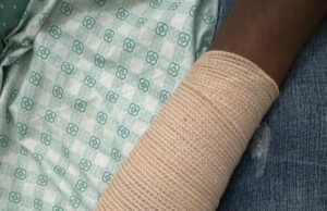 Allarme aggressioni a Nettuno: le vittime sono giovani bengalesi